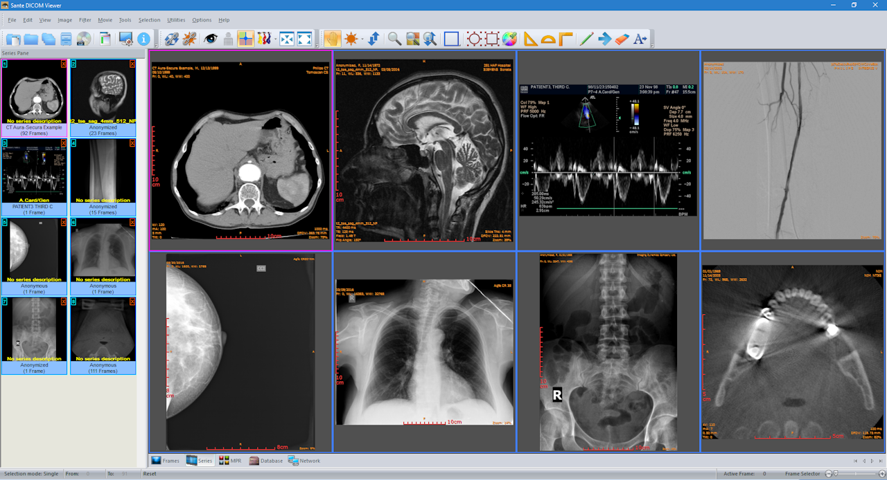 software to view mri images on mac